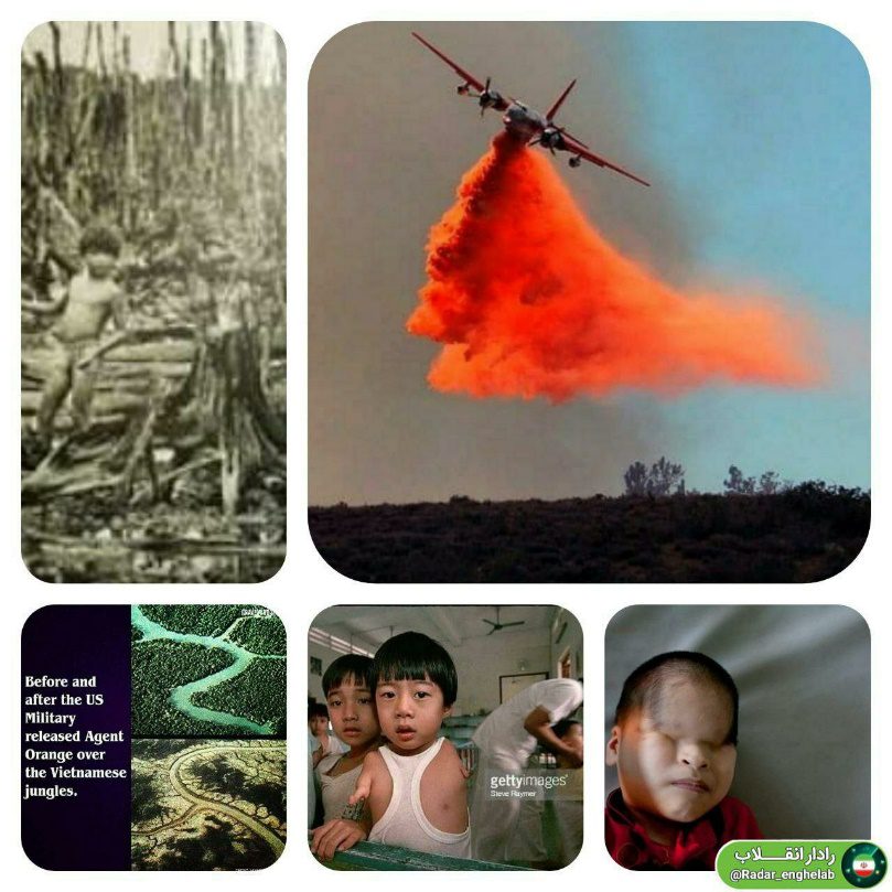 شکل 18: ارتش آمریکا در جریان جنگ ویتنام از سال ۱۹۶۱ تا ۱۹۷۱ میلادی از سلاح شیمیایی به نام عامل نارنجی استفاده‎ کرد که باعث سرطان و تولد نوزادان با نقص مادرزادی شد